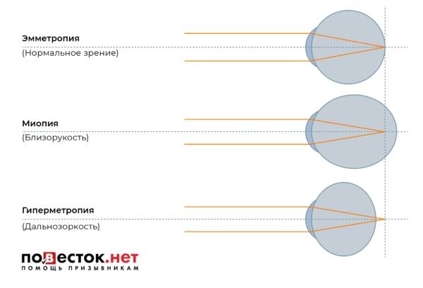 Почему хорошее зрение важно для службы в армии?