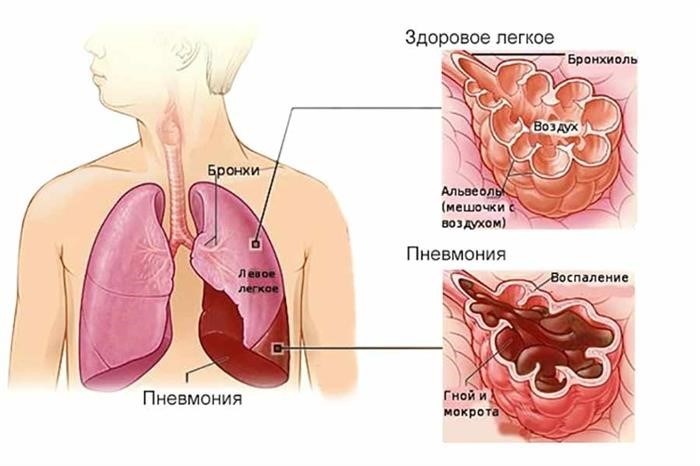 Возможная статья о праве на комиссование при заболевании